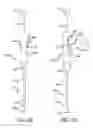 Fig. 03 - Methods and apparatus for treating disorders of the ear nose and throat