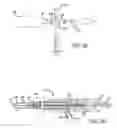 Fig. 06 - Methods and apparatus for treating disorders of the ear nose and throat