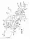 Fig. 08 - Methods and apparatus for treating disorders of the ear nose and throat