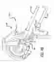 Fig. 09 - Methods and apparatus for treating disorders of the ear nose and throat