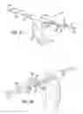 Fig. 10 - Methods and apparatus for treating disorders of the ear nose and throat
