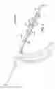 Fig. 12 - Methods and apparatus for treating disorders of the ear nose and throat