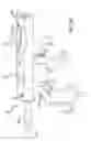 Fig. 15 - Methods and apparatus for treating disorders of the ear nose and throat