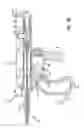 Fig. 16 - Methods and apparatus for treating disorders of the ear nose and throat