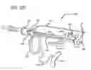 Fig. 20 - Methods and apparatus for treating disorders of the ear nose and throat