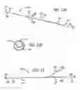 Fig. 23 - Methods and apparatus for treating disorders of the ear nose and throat
