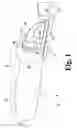 Fig. 02 - Device and method for improved surgical incisions
