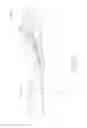 Fig. 34 - Ultrasonic surgical blade