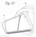 Fig. 15 - Hand held dermaplaning device and dermaplaning process