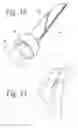 Fig. 16 - Hand held dermaplaning device and dermaplaning process