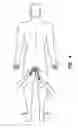Fig. 05 - Natural orifice surgery system