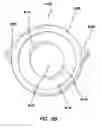 Fig. 08 - Natural orifice surgery system