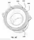 Fig. 09 - Natural orifice surgery system