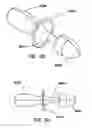 Fig. 13 - Natural orifice surgery system