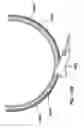 Fig. 33 - Natural orifice surgery system