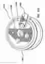 Fig. 40 - Natural orifice surgery system