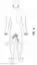 Fig. 05 - NATURAL ORIFICE ACCESS DEVICE