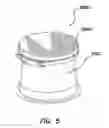 Fig. 06 - NATURAL ORIFICE ACCESS DEVICE