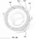 Fig. 09 - NATURAL ORIFICE ACCESS DEVICE