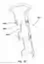 Fig. 18 - NATURAL ORIFICE ACCESS DEVICE