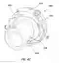 Fig. 27 - NATURAL ORIFICE ACCESS DEVICE