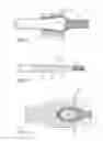 Fig. 03 - Spinal stabilization system with rigid and flexible elements