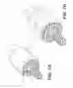 Fig. 13 - Self in-fusing pedicle screw implant