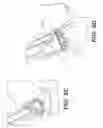 Fig. 15 - Self in-fusing pedicle screw implant