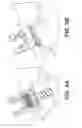 Fig. 18 - Self in-fusing pedicle screw implant