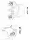 Fig. 19 - Self in-fusing pedicle screw implant
