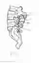 Fig. 02 - Multi-axial spinal fixation system