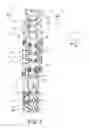Fig. 02 - Spinal correction and secondary stabilization