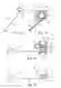 Fig. 07 - Spinal correction and secondary stabilization