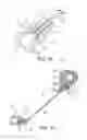 Fig. 08 - Spinal correction and secondary stabilization