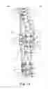 Fig. 09 - Spinal correction and secondary stabilization