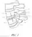 Fig. 02 - Methods, systems and apparatuses for torsional stabilization