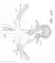 Fig. 35 - Methods, systems and apparatuses for torsional stabilization