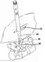 Fig. 01 - Methods and devices for spinal fixation element placement