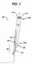 Fig. 02 - Methods and devices for spinal fixation element placement