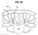 Fig. 05 - Methods and devices for spinal fixation element placement
