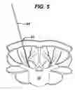 Fig. 07 - Methods and devices for spinal fixation element placement