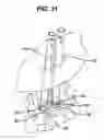 Fig. 13 - Methods and devices for spinal fixation element placement