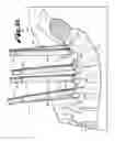 Fig. 16 - Bone anchor receiver with upper tool engaging grooves and planar faces