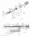 Fig. 03 - Intramedullary fracture fixation devices and methods