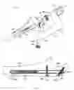 Fig. 04 - Intramedullary fracture fixation devices and methods
