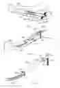 Fig. 06 - Intramedullary fracture fixation devices and methods