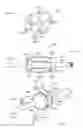 Fig. 08 - Intramedullary fracture fixation devices and methods