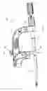 Fig. 22 - Intramedullary fracture fixation devices and methods