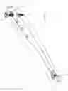 Fig. 29 - Intramedullary fracture fixation devices and methods