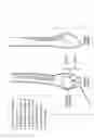 Fig. 32 - Intramedullary fracture fixation devices and methods